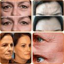 KIT Collagen Skin Botox™