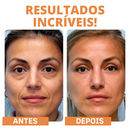 Skin Botox™ - Máscara de Colágeno Que Revitaliza Pele e Rugas [ATIVOS DO BOTOX] + Spray VitaC GRÁTIS