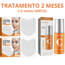 Skin Botox™ - Máscara de Colágeno Que Revitaliza Pele e Rugas [ATIVOS DO BOTOX] + Spray VitaC GRÁTIS