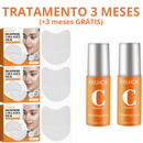 Skin Botox™ - Máscara de Colágeno Que Revitaliza Pele e Rugas [ATIVOS DO BOTOX] + Spray VitaC GRÁTIS