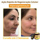 LOVILDS™ Creme Total com Veneno de Abelha – Testado e Aprovado por Especialistas nos EUA