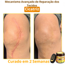 LOVILDS™ Creme Total com Veneno de Abelha – Testado e Aprovado por Especialistas nos EUA