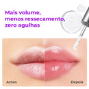 SpiculeShot – Tecnologia Coreana Que Aumenta o Volume e Deixa Efeito Preenchido