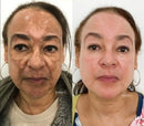 Revitta 577 Spray - Remove manchas do SOL, ENVELHECIMENTO e MELASMA