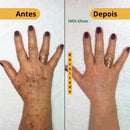 Revitta 577 Spray - Remove manchas do SOL, ENVELHECIMENTO e MELASMA