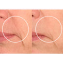 Kit Lift Care® - Sorriso